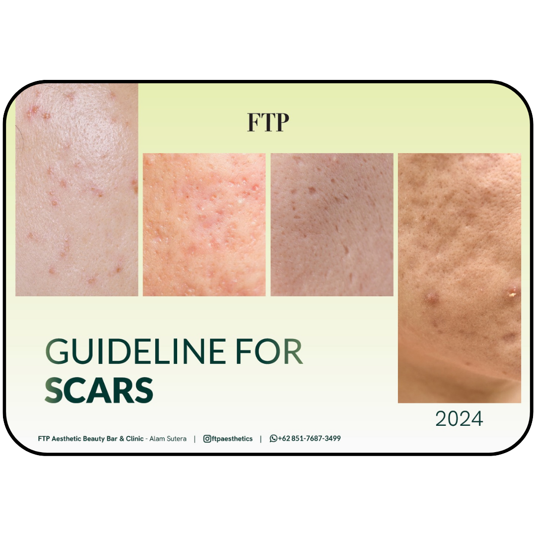 Scar guideline FTP Aesthetics