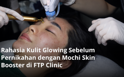 Rahasia Kulit Glowing Sebelum Pernikahan dengan Mochi Skin Booster di FTP Clinic